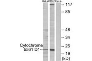 Image no. 1 for anti-Cytochrome B-561 Domain Containing 1 (CYB561D1) (AA 180-229) antibody (ABIN2889869) (CYB561D1 anticorps  (AA 180-229))