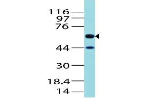 Image no. 1 for anti-Activin A Receptor Type II-Like 1 (ACVRL1) (AA 326-503) antibody (ABIN5027022) (ACVRL1 anticorps  (AA 326-503))