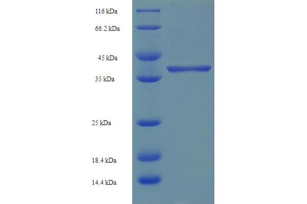 SRSF10 Protein (AA 1-183, full length) (His-SUMO Tag)