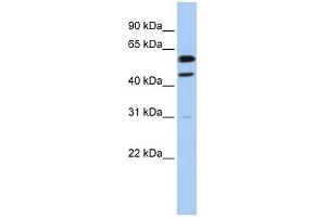 Cyclin B1 antibody used at 1 ug/ml to detect target protein. (Cyclin B1 anticorps  (Middle Region))