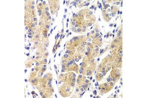 Immunohistochemistry of paraffin-embedded human gastric using HRAS antibody. (HRAS anticorps)