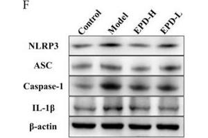 Western Blotting (WB) image for anti-Interleukin 1, beta (IL1B) (AA 101-200) antibody (ABIN728503)