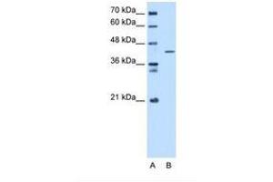 Image no. 1 for anti-Selenophosphate Synthetase 1 (SEPHS1) (C-Term) antibody (ABIN321507) (SEPHS1 anticorps  (C-Term))