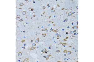 Immunohistochemistry of paraffin-embedded mouse brain using RARS antibody (ABIN5973728) at dilution of 1/100 (40x lens). (RARS anticorps)