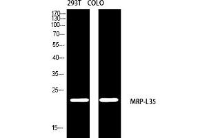 Western blot analysis of 293T COLO using MRP-L35 antibody. (MRPL35 anticorps  (AA 80-160))