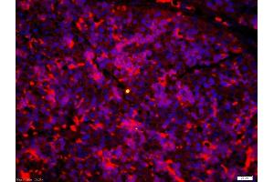 Immunofluorescence (Paraffin-embedded Sections) (IF (p)) image for anti-Leukotriene B4 Receptor (LTB4R) (AA 101-200) antibody (ABIN748628)