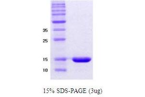 Figure annotation denotes ug of protein loaded and % gel used. (alpha Synuclein DeltaNAC (active) Protéine)