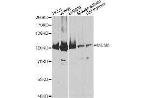 Western blot analysis of extracts of various cell lines, using MCM5 antibody. (MCM5 anticorps)