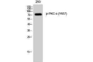 Western Blotting (WB) image for anti-Protein Kinase C, alpha (PKCa) (pTyr657) antibody (ABIN3179536) (PKC alpha anticorps  (pTyr657))