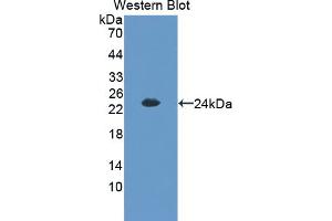 Western blot analysis of the recombinant protein. (CITED1 anticorps  (C-Term))