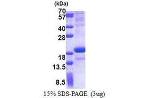 SDS-PAGE (SDS) image for Sodium Channel, Voltage-Gated, Type III, beta Subunit (SCN3B) (AA 23-159) protein (His tag) (ABIN7529250) (SCN3B Protein (AA 23-159) (His tag))