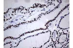 Image no. 1 for anti-Nibrin (NBN) (AA 183-460) antibody (ABIN1491056) (Nibrin anticorps  (AA 183-460))