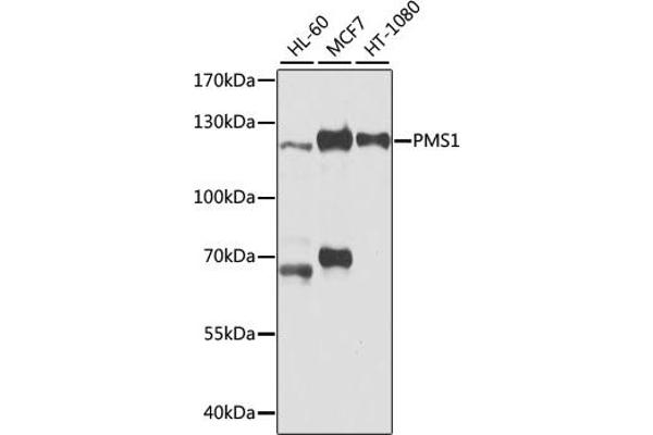 PMS1 anticorps  (AA 405-619)