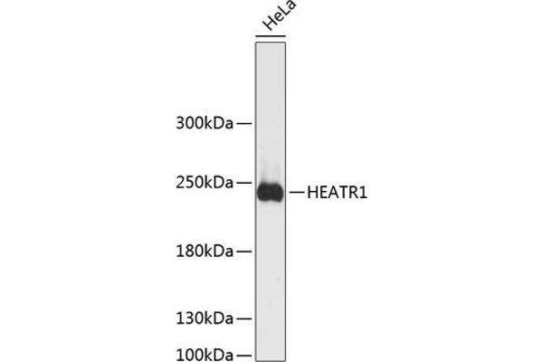 HEATR1 anticorps  (AA 1-120)