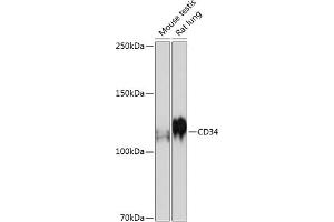 Western blot analysis of extracts of various cell lines, using CD34 antibody (ABIN7266187) at 1:500 dilution. (CD34 anticorps)