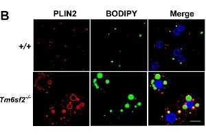 Immunofluorescence (IF) image for anti-Perilipin 2 (PLIN2) (AA 1-29), (N-Term) antibody (ABIN285650)