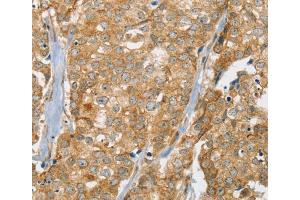 Immunohistochemistry (IHC) image for anti-Solute Carrier Family 9 (Sodium/hydrogen Exchanger), Member 3 Regulator 2 (SLC9A3R2) antibody (ABIN2427261) (SLC9A3R2 anticorps)