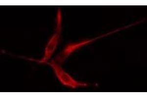 ABIN6275362 staining HeLa cells by IF/ICC. (Plakophilin 2 anticorps  (N-Term))