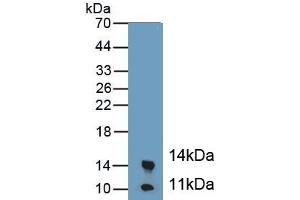 Detection of Recombinant CALPRO, Mouse using Polyclonal Antibody to Calprotectin (CALPRO) (Calprotectin anticorps  (AA 1-113))