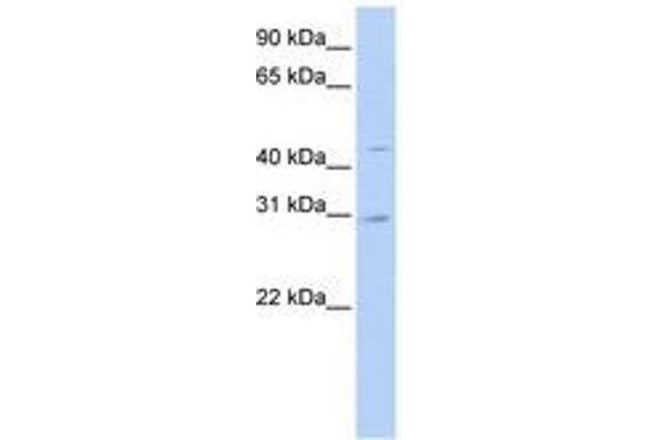SLC10A4 anticorps  (N-Term)
