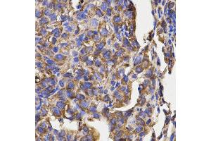 Immunohistochemistry (IHC) image for anti-Ribosomal Protein L5 (RPL5) antibody (ABIN1874650) (RPL5 anticorps)