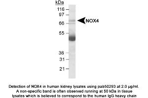 Image no. 1 for anti-NADPH Oxidase 4 (NOX4) (AA 100-200) antibody (ABIN363602) (NADPH Oxidase 4 anticorps  (AA 100-200))