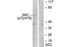 Western blot analysis of extracts from COLO205 cells treated with serum 15% 10', using Src (Phospho-Tyr418) Antibody. (Src anticorps  (pTyr419))