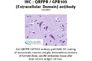 Image no. 1 for anti-Pyroglutamylated RFamide Peptide Receptor (QRFPR) (2nd Extracellular Domain) antibody (ABIN1738665) (QRFPR anticorps  (2nd Extracellular Domain))