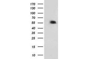 Western Blotting (WB) image for anti-Tumor Protein P53 (TP53) antibody (ABIN1499977) (p53 anticorps)