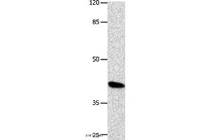 Western blot analysis of K562 cell, using POU5F1 Polyclonal Antibody at dilution of 1:500 (OCT4 anticorps)