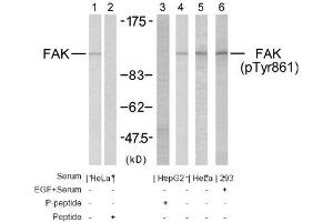 Image no. 2 for anti-PTK2 Protein tyrosine Kinase 2 (PTK2) (Tyr861) antibody (ABIN197234) (FAK anticorps  (Tyr861))