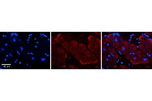 Rabbit Anti-AKAP7 Antibody    Formalin Fixed Paraffin Embedded Tissue: Human Adult heart  Observed Staining: Membrane Primary Antibody Concentration: 1:600 Secondary Antibody: Donkey anti-Rabbit-Cy2/3 Secondary Antibody Concentration: 1:200 Magnification: 20X Exposure Time: 0. (AKAP7 anticorps  (N-Term))