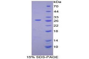 SDS-PAGE analysis of Human Coagulation Factor XII Protein. (F12 Protéine)