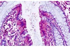 Human, Colon: Formalin-Fixed Paraffin-Embedded (FFPE) (PTGER4 anticorps  (C-Term))