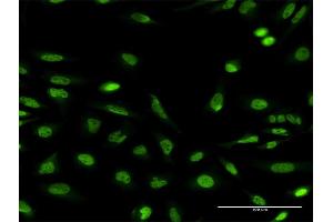 Immunofluorescence of monoclonal antibody to NBEA on HeLa cell. (Neurobeachin anticorps  (AA 1133-1220))