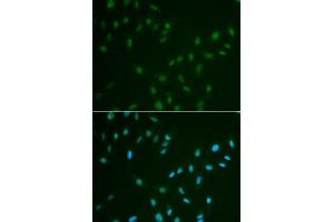 Immunofluorescence analysis of A549 cells using HSF2 antibody. (HSF2 anticorps)