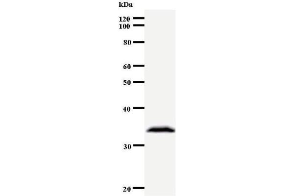 ARNTL2 anticorps