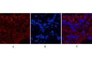 Immunofluorescence analysis of rat lung tissue. (CD4 anticorps)