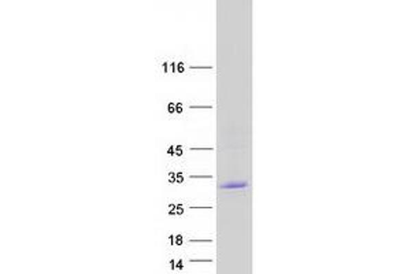 CABP1 Protein (Transcript Variant 1) (Myc-DYKDDDDK Tag)