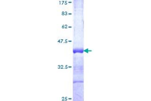 ROBO2 Protein (AA 441-540) (GST tag)