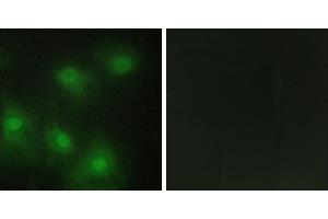 Peptide - +Western blot analysis of extracts from HUVEC cells, HepG2 cells and Jurkat cells, using CDK2 antibody. (CDK2 anticorps  (Internal Region))