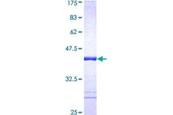 MAPKAP Kinase 5 Protein (AA 371-471) (GST tag)