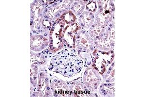 Immunohistochemistry (IHC) image for anti-Colony Stimulating Factor 1 (Macrophage) (CSF1) antibody (ABIN3002787) (M-CSF/CSF1 anticorps)