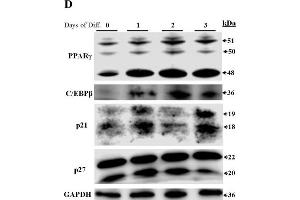 Western Blotting (WB) image for anti-Cyclin-Dependent Kinase Inhibitor 1B (p27, Kip1) (CDKN1B) (AA 150-198) antibody (ABIN672621)