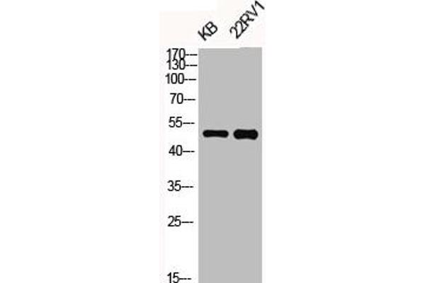 OPRK1 anticorps  (pSer369)