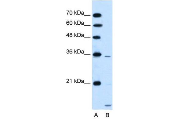 SLC25A39 anticorps  (C-Term)