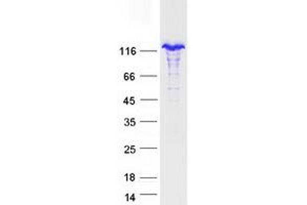 NFKB2 Protein (Transcript Variant 3) (Myc-DYKDDDDK Tag)