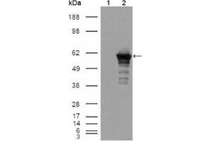 Western Blotting (WB) image for anti-Desmin (DES) antibody (ABIN1106977) (Desmin anticorps)