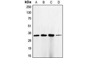 Western blot analysis of CDC2 expression in HeLa (A), K562 (B), MCF7 (C), A431 (D) whole cell lysates. (CDK1 anticorps  (Center))