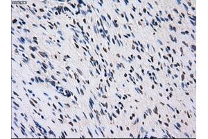 Immunohistochemical staining of paraffin-embedded colon tissue using anti-ID3mouse monoclonal antibody. (ID3 anticorps)